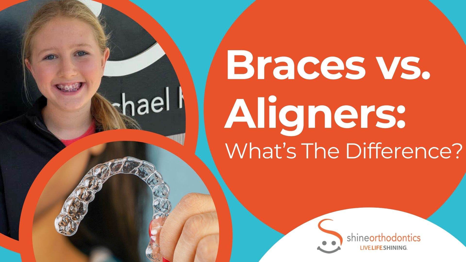 Girl smiling with braces and woman holding an aligner with text "Braces vs. Aligners: What's The Difference?" 
